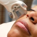 Which country is best for laser treatment?