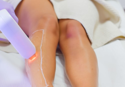 How many sessions of laser hair removal does it take to completely remove it?