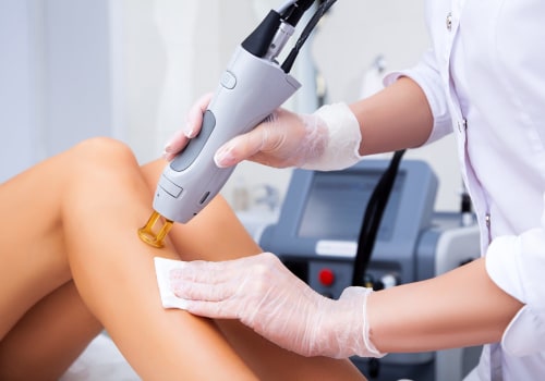 Say Goodbye To Razors: Discover Laser Hair Removal At Frankfort Med Spas