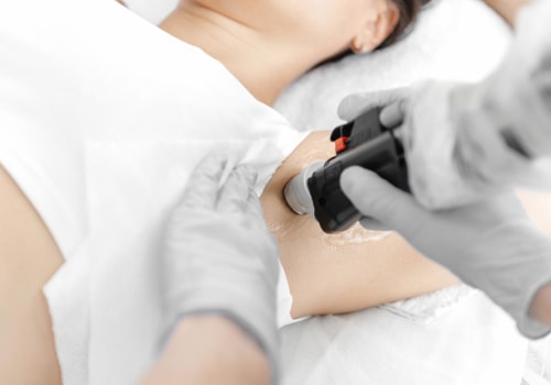 Collagen Microneedling: The Secret To Smoother Skin After Laser Hair Removal